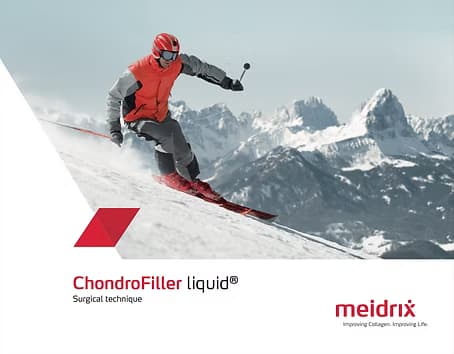 ChondroFiller Liquid — clinical technique brochure cover
